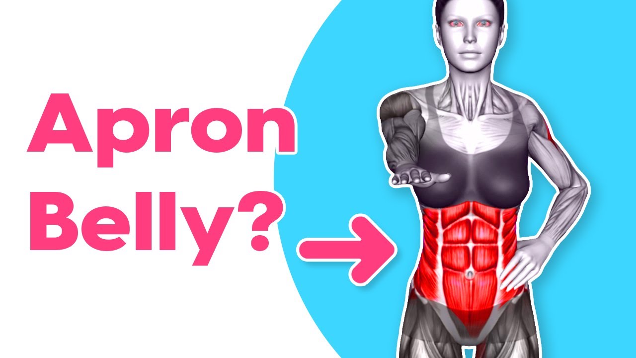 How to Get Rid of Apron Belly with Diet and Exercise